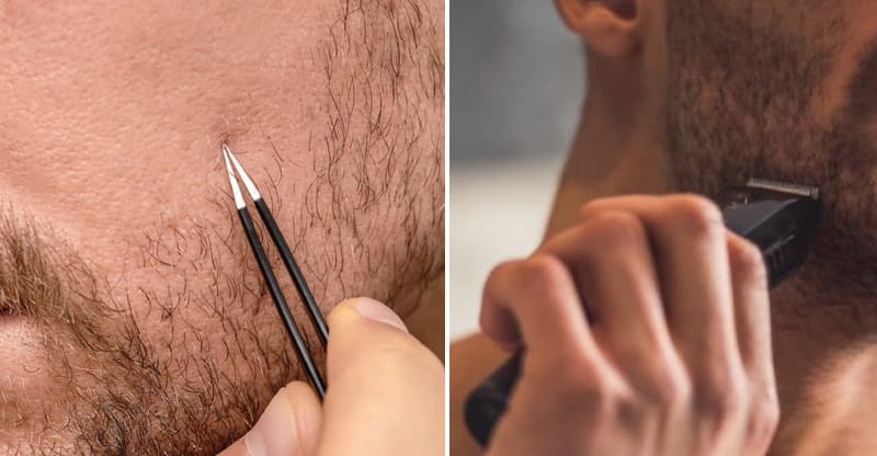 Nên nhổ hay cạo râu?