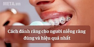 Cách đánh răng cho người niềng răng đúng cách, hiệu quả nhất