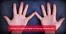 6 hoa tay có ý nghĩa gì? Người có 6 hoa tay sướng hay khổ?