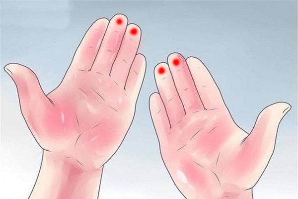 Tìm hiểu 4 hoa tay bán dầu mù u là gì