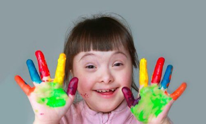 Ngày Hội chứng Down Thế giới